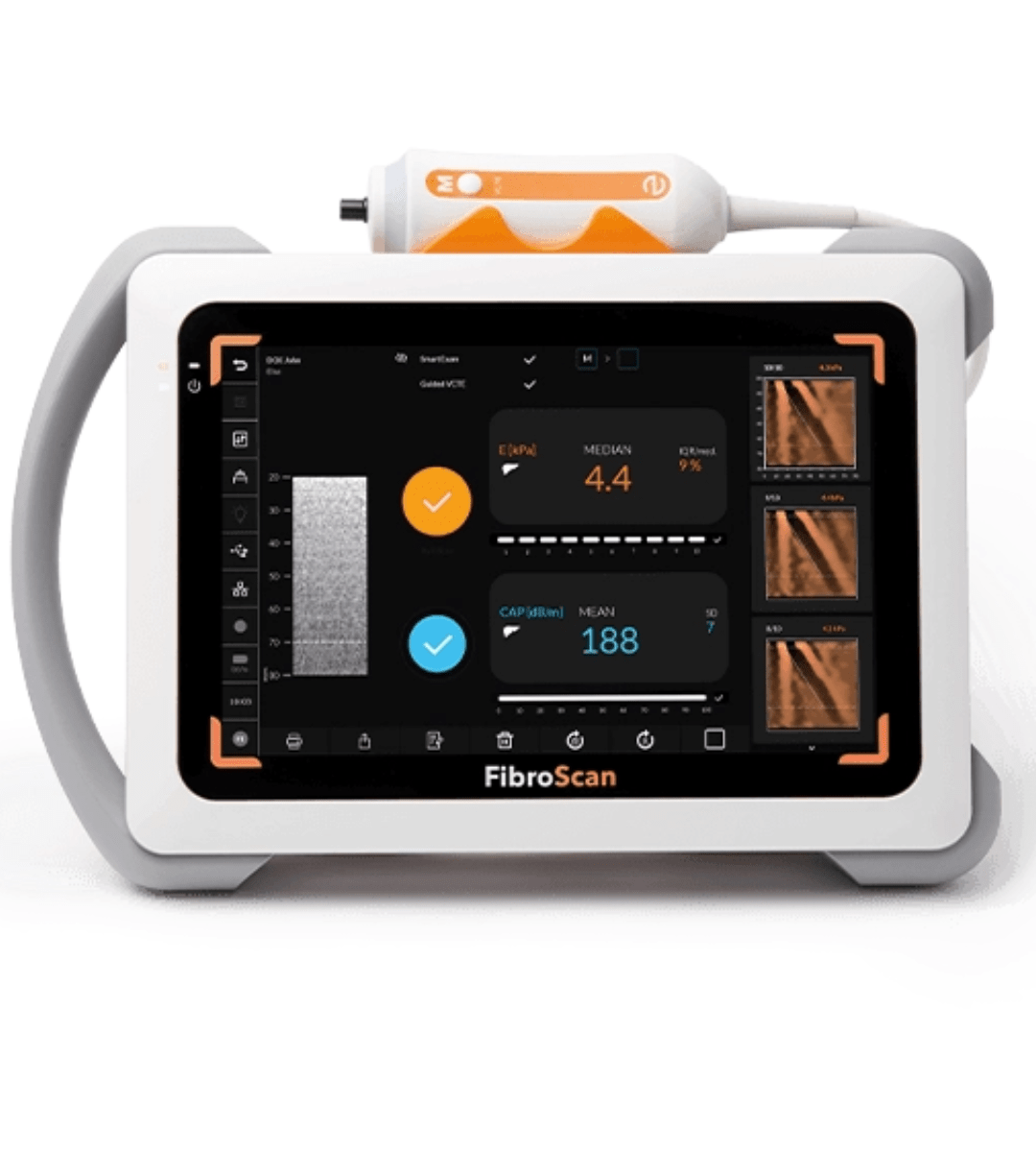 FIBROSCAN 430 Mini